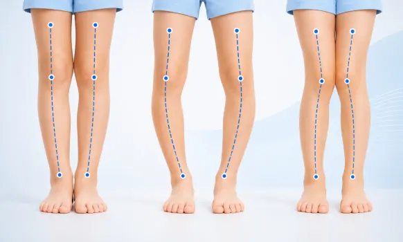 Children Feet Issues — illustration